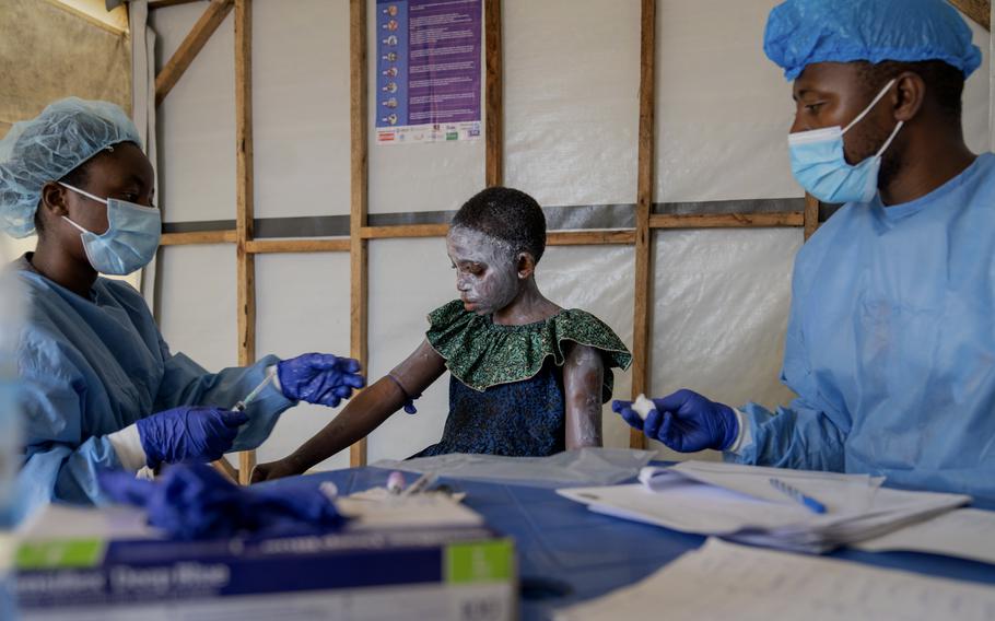 Congo’s humanitarian crisis helped mpox spiral again into a global health emergency – Watertown Daily Times