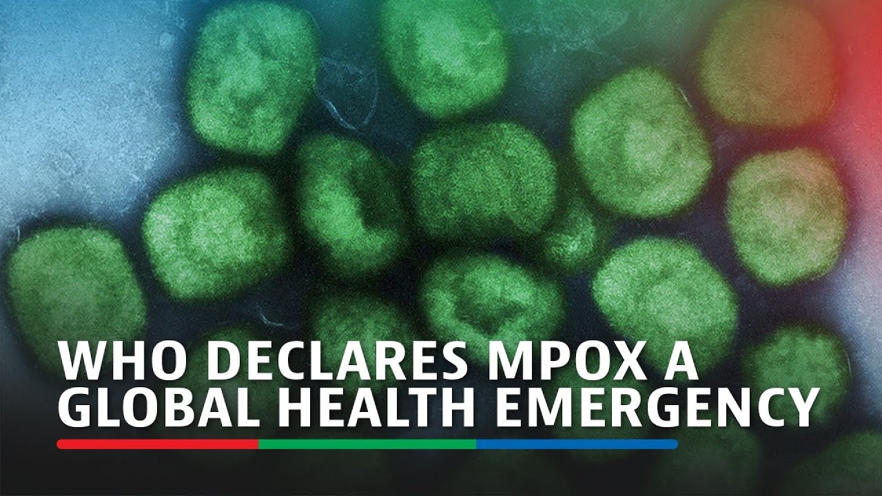 What we know about the mpox outbreak – ABS-CBN News